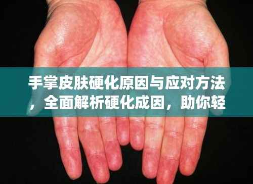 手掌皮肤硬化原因与应对方法,全面解析硬化成因,助你轻松应对